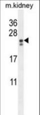 PIGX Antibody western blot of mouse kidney tissue lysates (35 ug/lane). The PIGX antibody detected the PIGX protein (arrow).