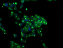 Immunofluorescent staining of HeLa cells using anti-MIF4GD mouse monoclonal antibody.