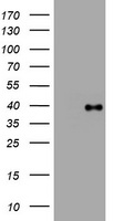 E.coli lysate (left lane) and E.coli lysate expressing human recombinant protein fragment corresponding to amino acids 230-560 of human PIK3C2A (NP_002636) were separated by SDS-PAGE and immunoblotted with anti-PIK3C2A.