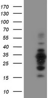 HEK293T cells were transfected with the pCMV6-ENTRY control (Left lane) or pCMV6-ENTRY MIF4GD (Right lane) cDNA for 48 hrs and lysed. Equivalent amounts of cell lysates (5 ug per lane) were separated by SDS-PAGE and immunoblotted with anti-MIF4GD.