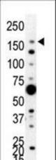 Western blot of anti-PIK3C2A antibody in 293 cell lysate. PIK3C2A (arrow) was detected using purified antibody. Secondary HRP-anti-rabbit was used for signal visualization with chemiluminescence.