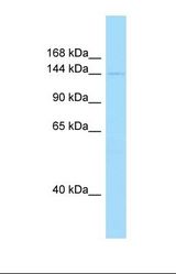 Western blot of Human Hela. PIK3C2A antibody dilution 1.0 ug/ml.