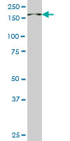 PIK3C2B monoclonal antibody (M06), clone 1H4. Western blot of PIK3C2B expression in HeLa NE.