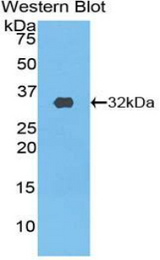 Western blot of recombinant PIK3C2B.