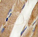Formalin-fixed and paraffin-embedded human skeletal muscle tissue reacted with PI3KC3 Antibody (S425), which was peroxidase-conjugated to the secondary antibody, followed by DAB staining. This data demonstrates the use of this antibody for immunohistochemistry; clinical relevance has not been evaluated.