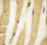 Formalin-fixed and paraffin-embedded human skeletal muscle tissue reacted with PI3KC3 Antibody (S164) , which was peroxidase-conjugated to the secondary antibody, followed by DAB staining. This data demonstrates the use of this antibody for immunohistochemistry; clinical relevance has not been evaluated.