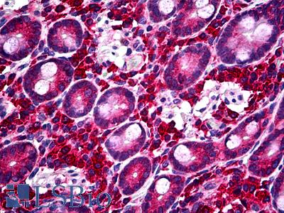 Anti-PIK3CB antibody IHC of human small intestine. Immunohistochemistry of formalin-fixed, paraffin-embedded tissue after heat-induced antigen retrieval. Antibody LS-B5359 concentration 5 ug/ml.