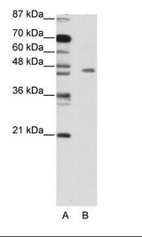 A: Marker, B: Jurkat Cell Lysate