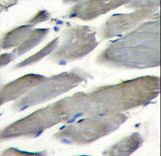 Formalin-fixed and paraffin-embedded skeletal muscle tissue reacted with PI3KCG antibody , which was peroxidase-conjugated to the secondary antibody, followed by DAB staining. This data demonstrates the use of this antibody for immunohistochemistry; clinical relevance has not been evaluated.