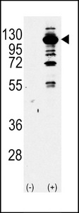 Western blot of PI3KCG Antibody antibody (arrow) using purified antibody. 293 cell lysates (2 ug/lane) either nontransfected (Lane 1) or transiently transfected with the PI3KCG gene (Lane 2) (Origene Technologies).