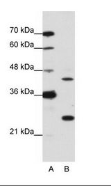 A: Marker, B: HepG2 Cell Lysate