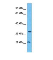Western blot of Human Breast Tumor. MINA antibody dilution 1.0 ug/ml.