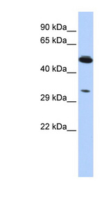 PIK3IP1 antibody LS-C102355 Western blot of HCT15 cell lysate.