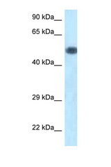 PIK3R1 / p85 Alpha antibody LS-C145427 Western blot of Mouse Brain lysate. Antibody concentration 1 ug/ml.