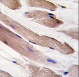 Formalin-fixed and paraffin-embedded human skeletal muscle tissue reacted with PIK3R1-pY580, which was peroxidase-conjugated to the secondary antibody, followed by DAB staining. This data demonstrates the use of this antibody for immunohistochemistry; clinical relevance has not been evaluated.