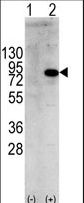Western blot of PIK3R1 (arrow) using rabbit polyclonal PIK3R1 Antibody (Y580). 293 cell lysates (2 ug/lane) either nontransfected (Lane 1) or transiently transfected with the PIK3R1 gene (Lane 2) (Origene Technologies).