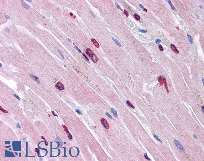 Anti-MINA antibody IHC of human heart. Immunohistochemistry of formalin-fixed, paraffin-embedded tissue after heat-induced antigen retrieval. Antibody LS-B5075 concentration 5 ug/ml.