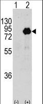 Western blot of PIK3R2 (arrow) using rabbit polyclonal PIK3R2 Antibody (T447) (RB13726). 293 cell lysates (2 ug/lane) either nontransfected (Lane 1) or transiently transfected with the PIK3R2 gene (Lane 2) (Origene Technologies).