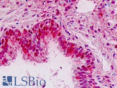 Human Lung: Formalin-Fixed, Paraffin-Embedded (FFPE)
