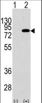 Western blot of PIK3R2 (arrow) using rabbit polyclonal PIK3R2 Antibody (Y467) (RB13091). 293 cell lysates (2 ug/lane) either nontransfected (Lane 1) or transiently transfected with the PIK3R2 gene (Lane 2) (Origene Technologies).