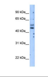 Transfected 293T cell lysate. Antibody concentration: 5.0 ug/ml. Gel concentration: 12%.