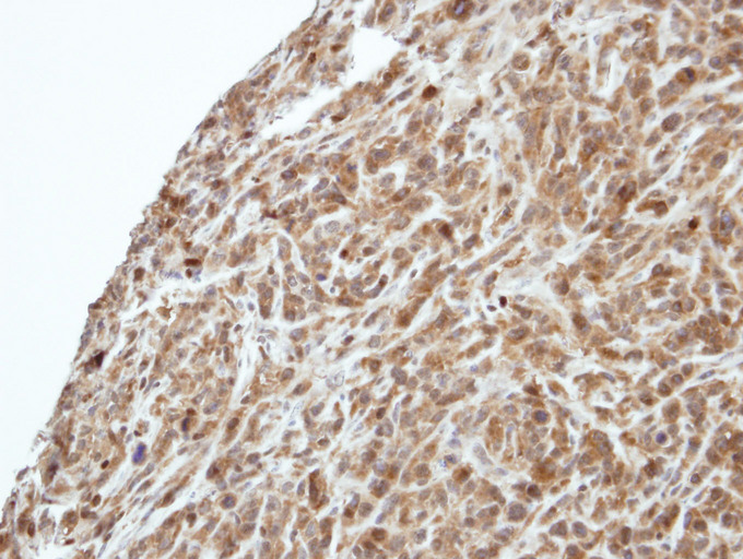 IHC of paraffin-embedded SAS xenograft using PIK3R3 antibody at 1:500 dilution.
