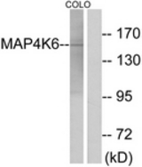Western blot of extracts from COLO cells, using MAP4K6 Antibody. The lane on the right is treated with the synthesized peptide.
