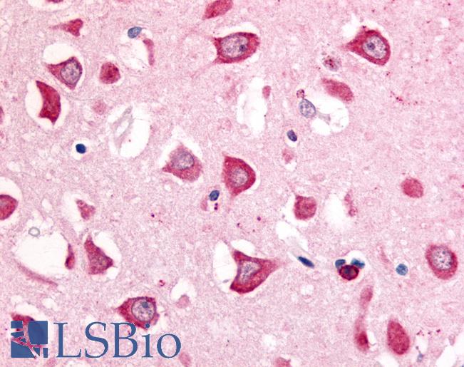Anti-MINK1 / MAP4K6 antibody LS-A7412 IHC of human hippocampus. Immunohistochemistry of formalin-fixed, paraffin-embedded tissue after heat-induced antigen retrieval.
