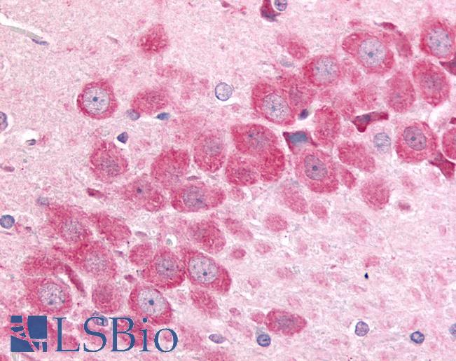 Anti-MINK1 / MAP4K6 antibody LS-A7412 IHC of rat hippocampus. Immunohistochemistry of formalin-fixed, paraffin-embedded tissue after heat-induced antigen retrieval.