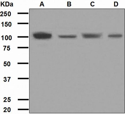 Western blot analysis on (A) HeLa, (B) SH-SY5Y, (C) BxPC-3, and (D) Jurkat cell lysates using anti-PI4-kinase beta antibody.
