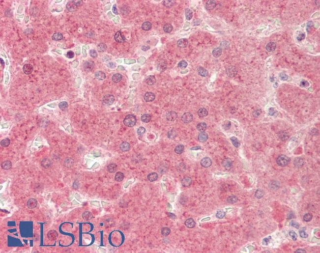Anti-PIK4CB / PI4KB antibody IHC staining of human liver. Immunohistochemistry of formalin-fixed, paraffin-embedded tissue after heat-induced antigen retrieval. Antibody LS-B10814 concentration 5 ug/ml.