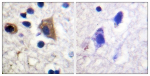 IHC of paraffin-embedded human brain tissue, using PIP5K Antibody. The sample on the right was incubated with synthetic peptide.