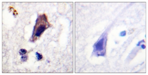 IHC of paraffin-embedded human brain, using PIP5K (Phospho-Ser307) Antibody. The sample on the right was incubated with synthetic peptide.