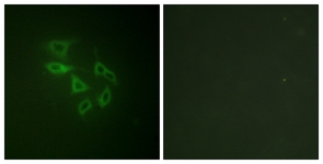 Immunofluorescence of HeLa cells, using PIP5K (Phospho-Ser307) Antibody. The sample on the right was incubated with synthetic peptide.