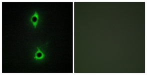 Immunofluorescence of COS7 cells, using PIP5K Antibody. The picture on the right is treated with the synthesized peptide.
