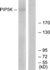 Western blot of extracts from HepG2 cells, using PIP5K Antibody. The lane on the right is treated with the synthesized peptide.