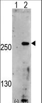 Western blot of PIP5K3 (arrow) using rabbit polyclonal PIP5K3 Antibody. 293 cell lysates (2 ug/lane) either nontransfected (Lane 1) or transiently transfected with the PIP5K3 gene (Lane 2) (Origene Technologies).