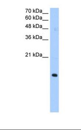 HepG2 cell lysate. Antibody concentration: 0.5 ug/ml. Gel concentration: 15%.