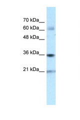 PIM1 antibody LS-C107526 Western blot of Fetal Heart lysate. Antibody concentration 1 ug/ml.