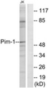 Western blot of extracts from Jurkat cells, using Pim-1 (Ab-309) Antibody. The lane on the right is treated with the synthesized peptide.