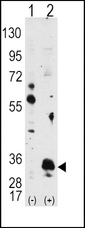 Western blot of PIM1 (arrow) using PIM1 Antibody. 293 cell lysates (2 ug/lane) either nontransfected (Lane 1) or transiently transfected with the PIM1 gene (Lane 2) (Origene Technologies).