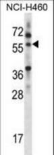 MINPP1 Antibody western blot of NCI-H460 cell line lysates (35 ug/lane). The MINPP1 antibody detected the MINPP1 protein (arrow).