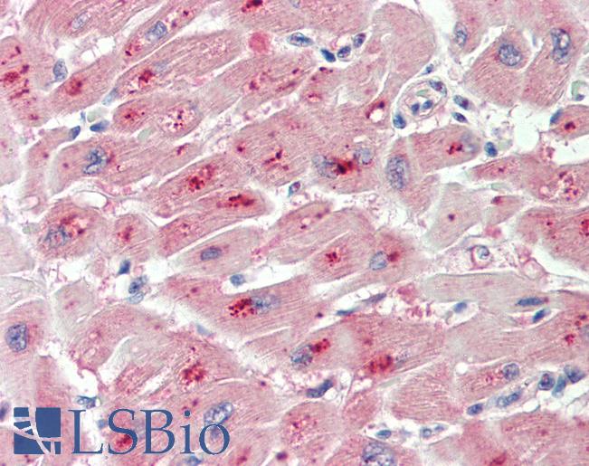 Human, Heart: Formalin-Fixed Paraffin-Embedded (FFPE)