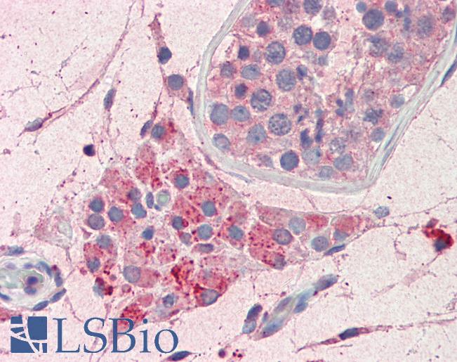 Human, Testis: Formalin-Fixed Paraffin-Embedded (FFPE)