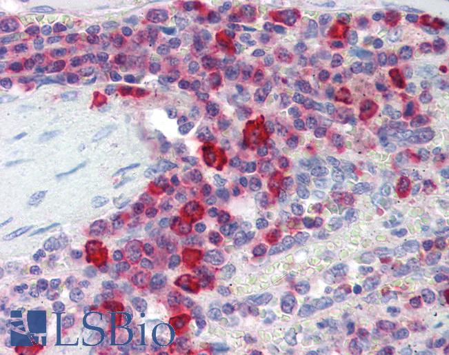 Anti-PIM3 antibody IHC of human spleen. Immunohistochemistry of formalin-fixed, paraffin-embedded tissue after heat-induced antigen retrieval. Antibody LS-B3461 concentration 10 ug/ml.
