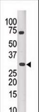The anti-PIM3 antibody is used in Western blot to detect PIM3 in mouse kidney tissue lysate.
