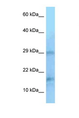 PIN1 antibody LS-C146316 Western blot of Jurkat Cell lysate. Antibody concentration 1 ug/ml.