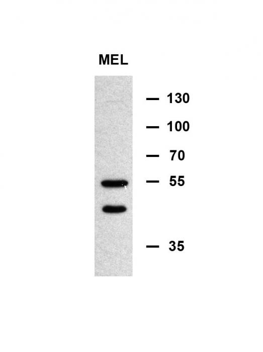 MINPP1 Antibody western blot of murine erythroleukemia cell line lysates (35 ug/lane). The MINPP1 antibody detected the MINPP1 protein (arrow). (Kindly offered by Doc. Normal)