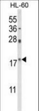 Western blot of PIN1 Antibody in HL-60 cell line lysates (35 ug/lane). PIN1 (arrow) was detected using the purified antibody.
