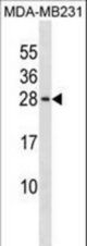 PIN4 Antibody western blot of MDA-MB231 cell line lysates (35 ug/lane). The PIN4 antibody detected the PIN4 protein (arrow).